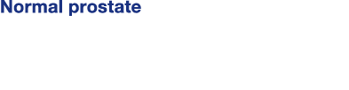 Normal prostate