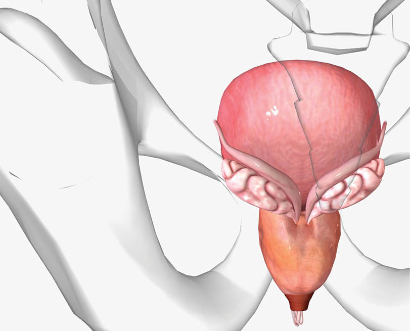 Benign prostatic hyperplasia (BPH) is a non-cancerous condition in which the prostate becomes enlarged with age.3D rendering