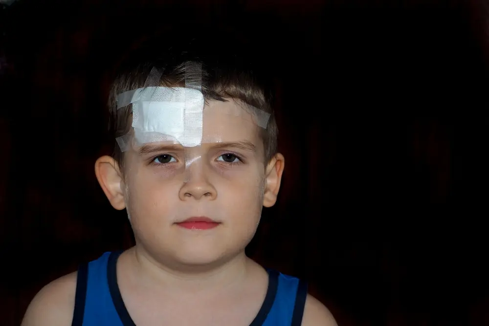 A child's head injury. A little boy with a large white patch on his forehead after an injury.