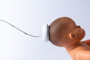 Photograph of a baby with the VAP system attached to his/her head