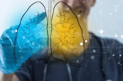 An illustrated comparison of Asthma and COPD