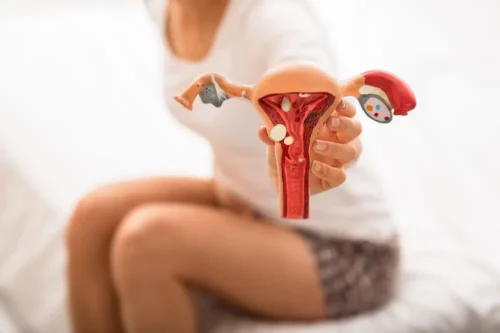 Blurred woman with abdominal pain holds the anatomical model of uterus and ovaries with pathology. diseases uterus and ovaries, endometriosis, ovarian cysts.