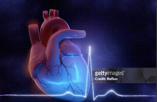 A comprehensive visual representation of an ischaemic heart