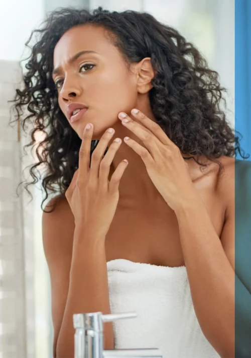 A photograph of a beautiful young woman examining her skin for any outbreaks of acne